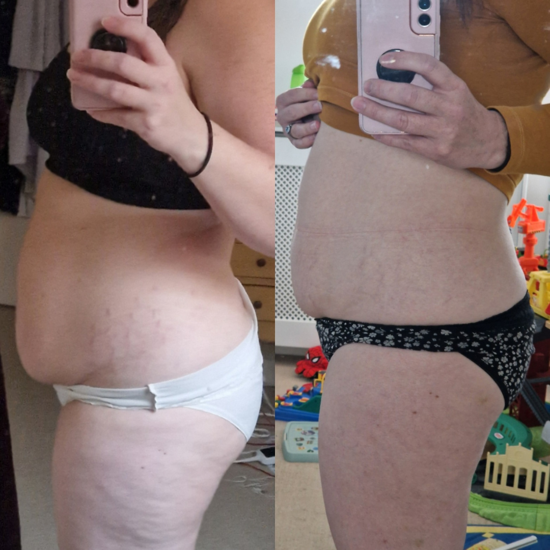 Amy's progress after 2nd baby 